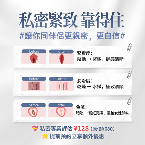 私密緊緻1.jpg